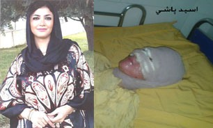 تهمینه، قربانی اسیدپاشی