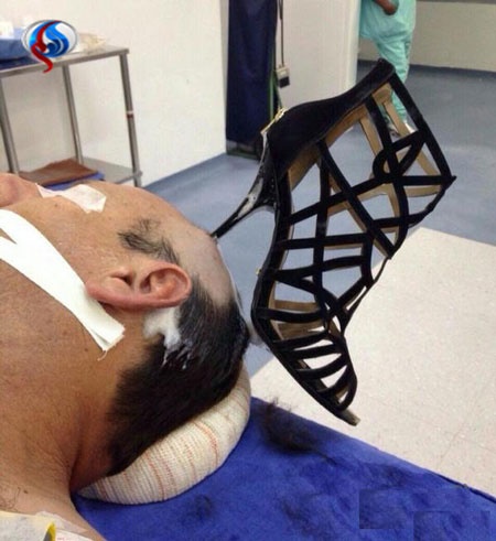 پاشنه کفش در سر مرد عرب جاماند/ دعوای خانوادگی به اورژانس کشید