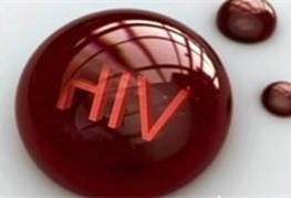گامی مهم در درمان ایدز/ روشی که ویروس اچ آی وی را از مخفیگاه بیرون می کشد