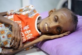 عکس| تصویر دردناک دختر یمنی سوژه شبکه‌های اجتماعی شد