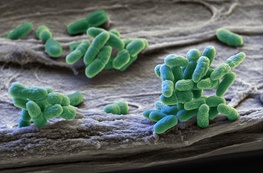 کشف مقاوم‌ترین باکتری جهان