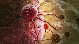 نتایج خارق‌العاده ایمونوتراپی در درمان سرطان/روش جدید درمان بیماران سرطانی را متحول می‌کند؟