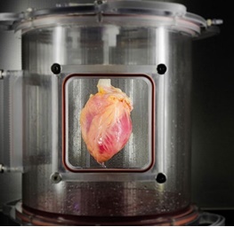 کشت اولین ماهیچه قلب کاربردی از سلول‌های بنیادین/پیوند قلب راحت‌تر می‌شود؟