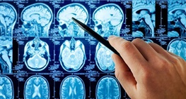 بخشی از مغز که در موقع شرارت‌ها فعال می‌شود/فناوری پزشکی می‌تواند جلوی جرم را بگیرد؟