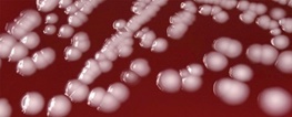 مرگبارترین باکتری‌های مقاوم‌ در برابر آنتی‌بیوتیک را بشناسید/فهرست سازمان بهداشت جهانی