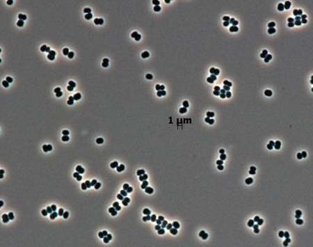 شناسایی یک میکروب کمیاب در استریل‌ترین جای زمین