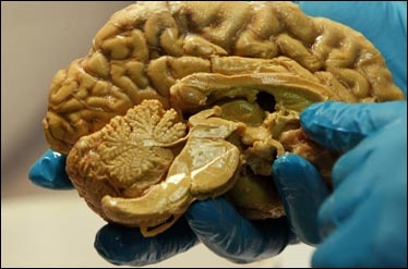 مغز بزرگ، چطور انسان را به باهوش‎ترین موجود روی زمین تبدیل کرد؟