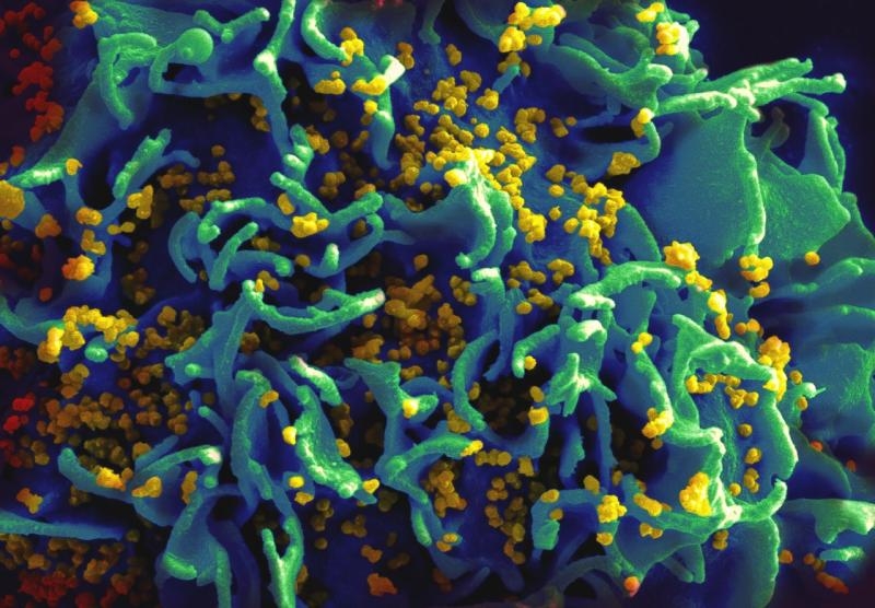 کشف راهبردی در درمان ایدز: ویروس HIV چطور سلول‌های ایمنی را می‌کشد؟