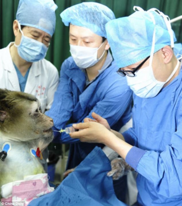 پیوند موفقیت آمیز کبد یک حیوان شبیه سازی شده به یک میمون در چین