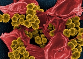 خسارت‌های باورنکردنی مقاومت آنتی‌بیوتیک: 300,000,000 نفر کشته و 100,000,000,000,000 دلار هزینه