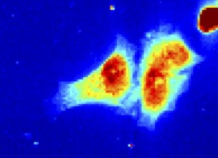 نخستین تصویر اشعه ایکس از یک سلول زنده