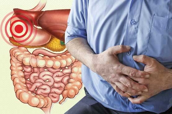اگر اقوام درجه یک تان سرطان معده دارند حتما به پزشک متخصص مراجعه کنید