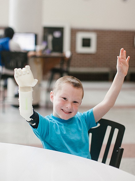  پیوند موفقیت آمیز بازوی رباتیک 