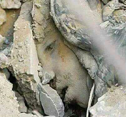 عکس کودکی که زیر بمباران سعودیها، دفن شد