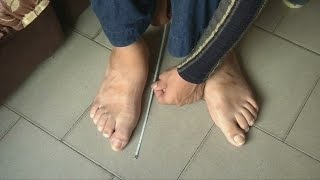 رکورد گینس برای بزرگترین پاهای دنیا