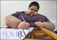 چاقی کودکان در مازندران نگران‌کننده است