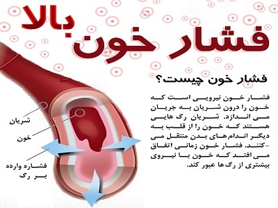 فشارخون بالا را چطور مهار کنیم؟