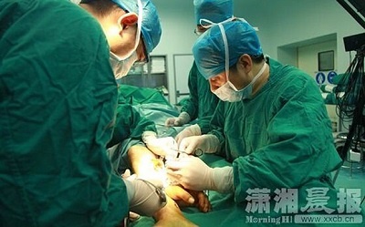 تصویری از راه حل جراحان چینی برای زنده نگاه داشتن دست قطع شده 