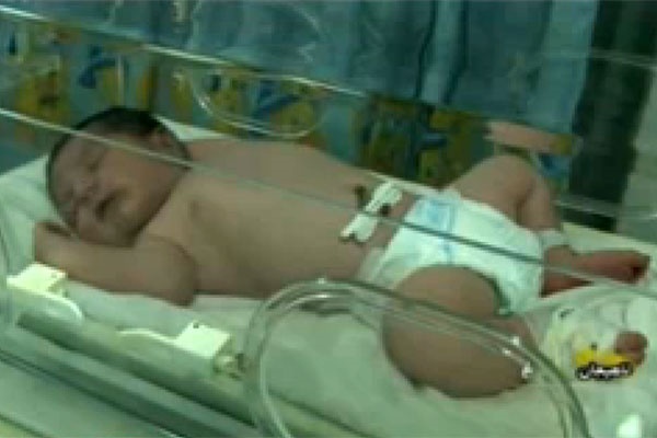 فیلم | تولد نوزادی با وزن بیش از ۵ کیلوگرمی در لاهیجان