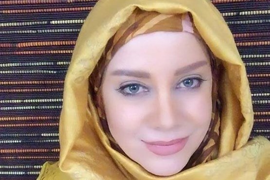 پیشنهاد عجیب به بازیگر زن در اینستاگرام / وقتی عمل زیبایی دردسرساز می‌شود