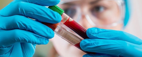 یک آزمایش ساده خون با توانایی تشخیص پنج نوع سرطان/ تشخیص زودهنگام سرطان راحت‌تر می‌شود
