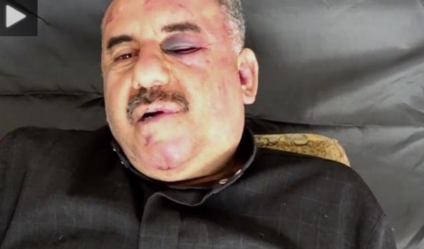 آثار شکنجه بر چهره خلبان سوری