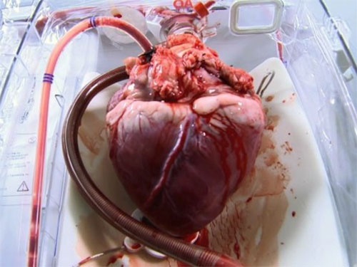 تلاش دانشمندان برای ساخت قلب مصنوعی اتمی/دوران باتری قلب به پایان می‌رسد؟ 