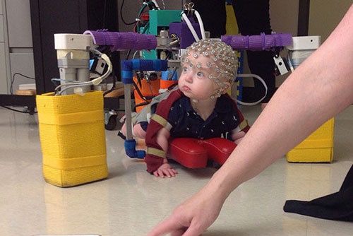  درمان فلج مغزی نوزادان با ربات/فناوری جدید پزشکی