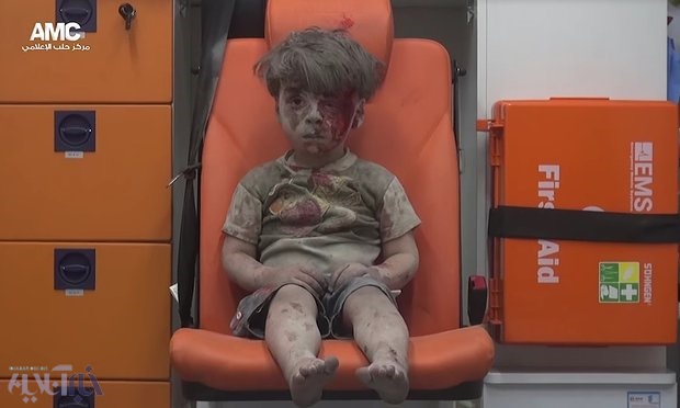 عکس | نگاه دردناک کودک سوری که از زیر آوار بیرون کشیده شد