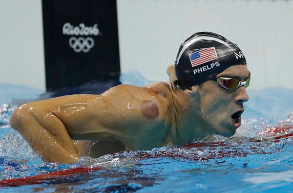 ماجرای لکه‌های کبود روی بدن مایکل فلپس در المپیک چه بود؟