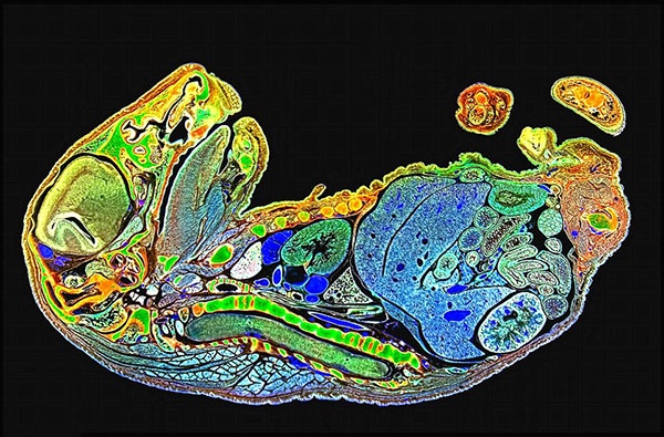عکس میکروسکوپی شگفت‌انگیز از جنین موش را ببینید /مشاهده آناتومی بدن یک موش 