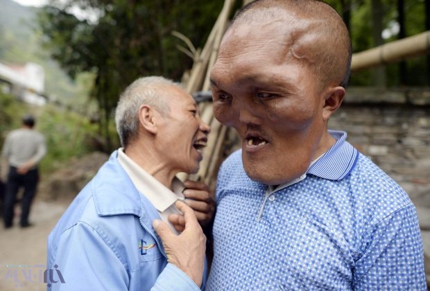 تصاویر | بیماری عجیب و غریب مرد چینی 