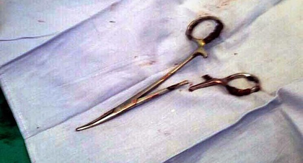 این قیچی ۱۹ سال در بدن یک بیمار جا مانده بود!
