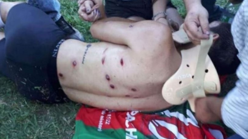 تصاویر | تیراندازی وحشیانه پلیس آرژانتین به بازیکنان فوتبال 