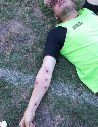 تصاویر | تیراندازی وحشیانه پلیس آرژانتین به بازیکنان فوتبال 