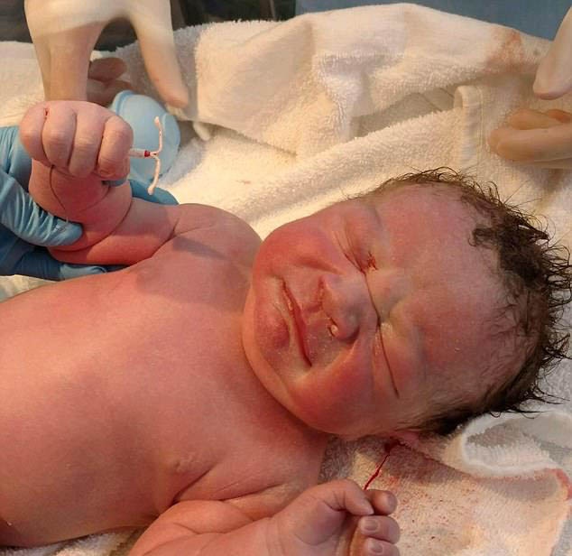 عکسی که در دنیا جنجالی شد؛ پسر بچه یک درصدی که با وجود آی‌یودی به دنیا آمد!