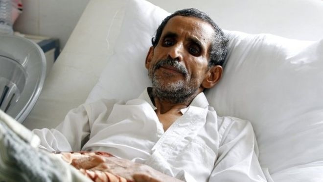 روزگار سخت مردم یمن در مواجهه با مرگ/ بمباران سعودی‌ها و شیوع بیماری وبا