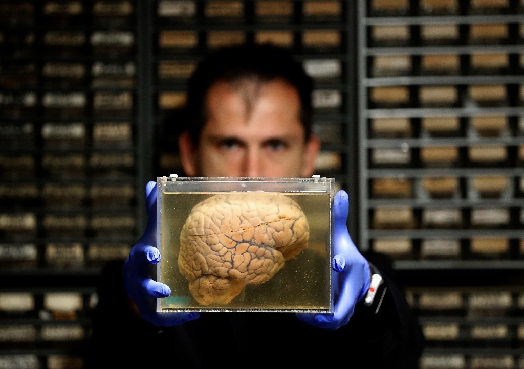تصاویر مرکزی که ۳۰۰۰ مغز انسان در آن نگهداری می‌شود!