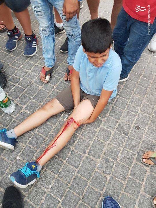 تصاویر | ۴ کودک فلسطینی که با خودروی یک صهیونیست زیر گرفته شدند