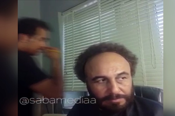 فیلم | دردسرهای جدا کردن موی مصنوعی از سر رضا عطاران!