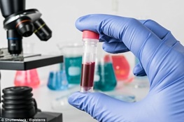 انقلاب در آزمایش خون با تشخیص ۱۰ نوع سرطان، قبل از ظهور بیماری