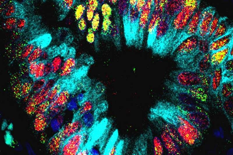 تدوین اولین اطلس کامل سلول‌های تومور ریه توسط محققان بلژیکی