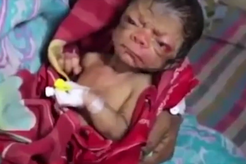 فیلم | وحشتناک‌ترین نوزاد جهان به دنیا آمد (۱۴+)